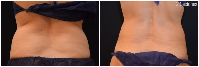 PAC16-FLANCOSABDOMEN-768x259