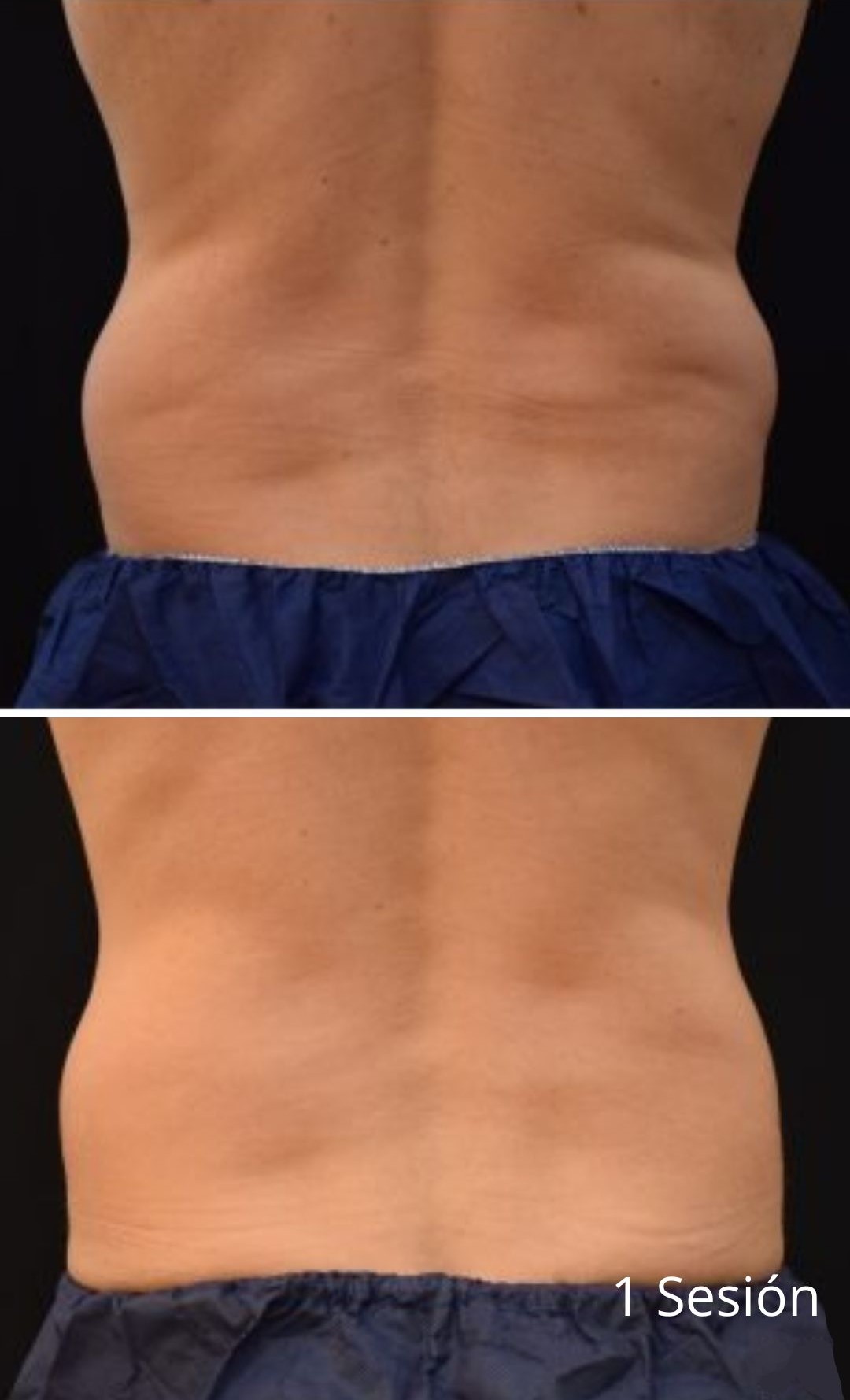2 Sesiones - 1