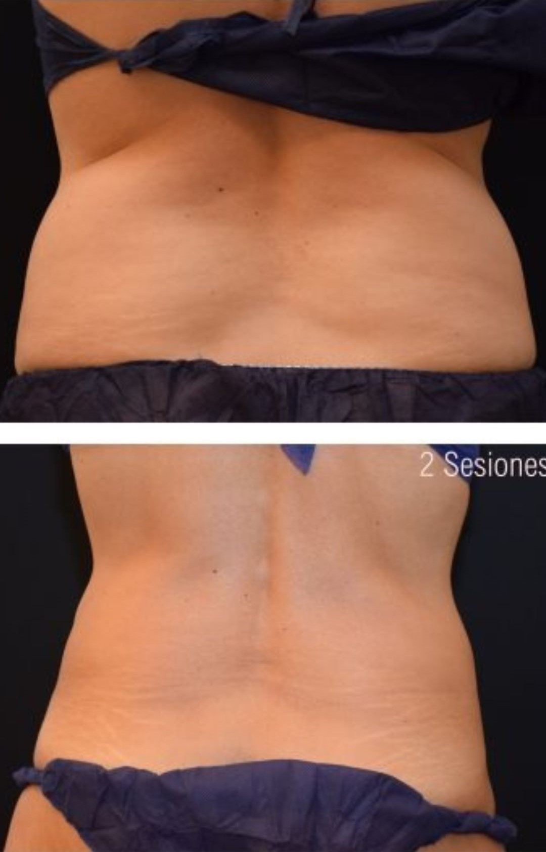 2 Sesiones - 1