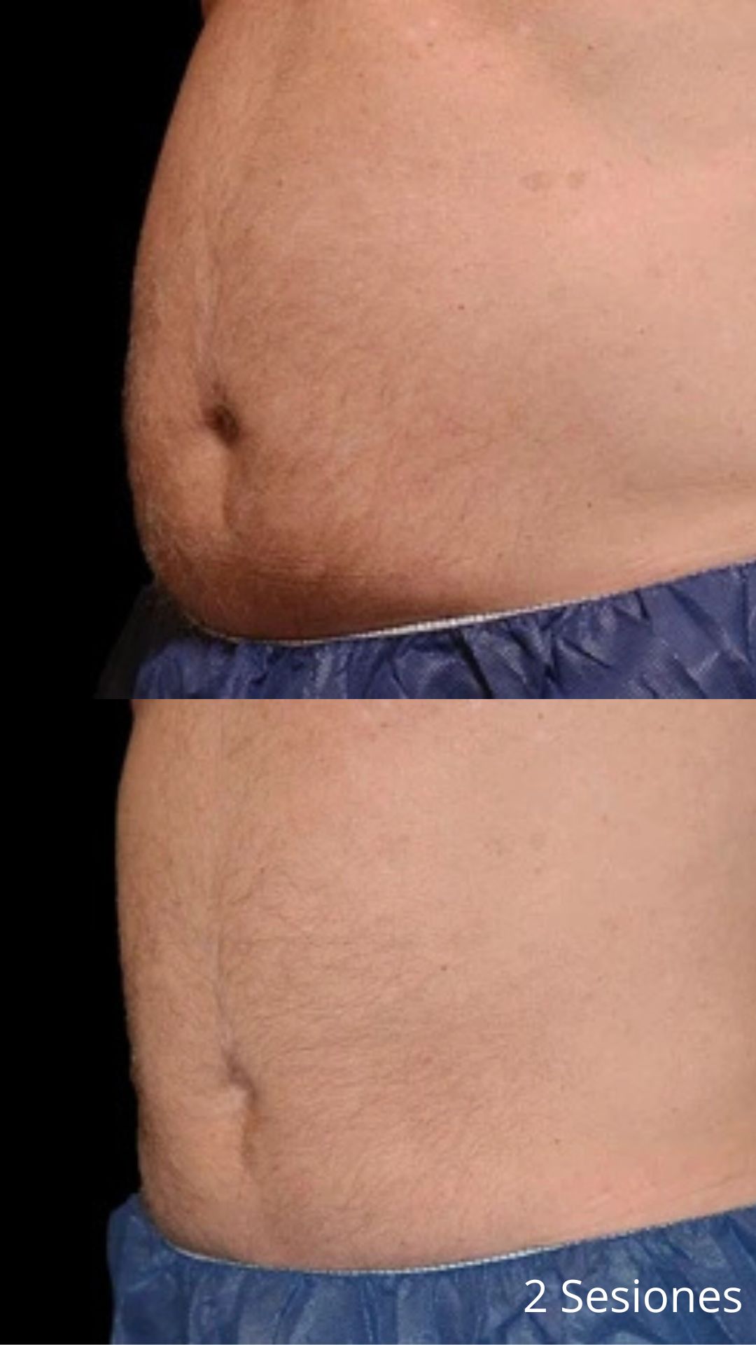 2 Sesiones